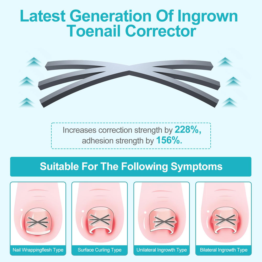 VITASY 6-angle corrector in-use shows adaptive correction for curved nails.