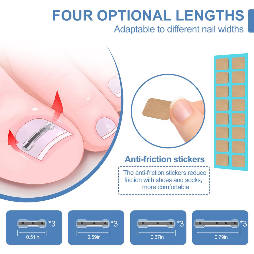 VITASY titanium alloy corrector demonstrates durable support for curved nails.