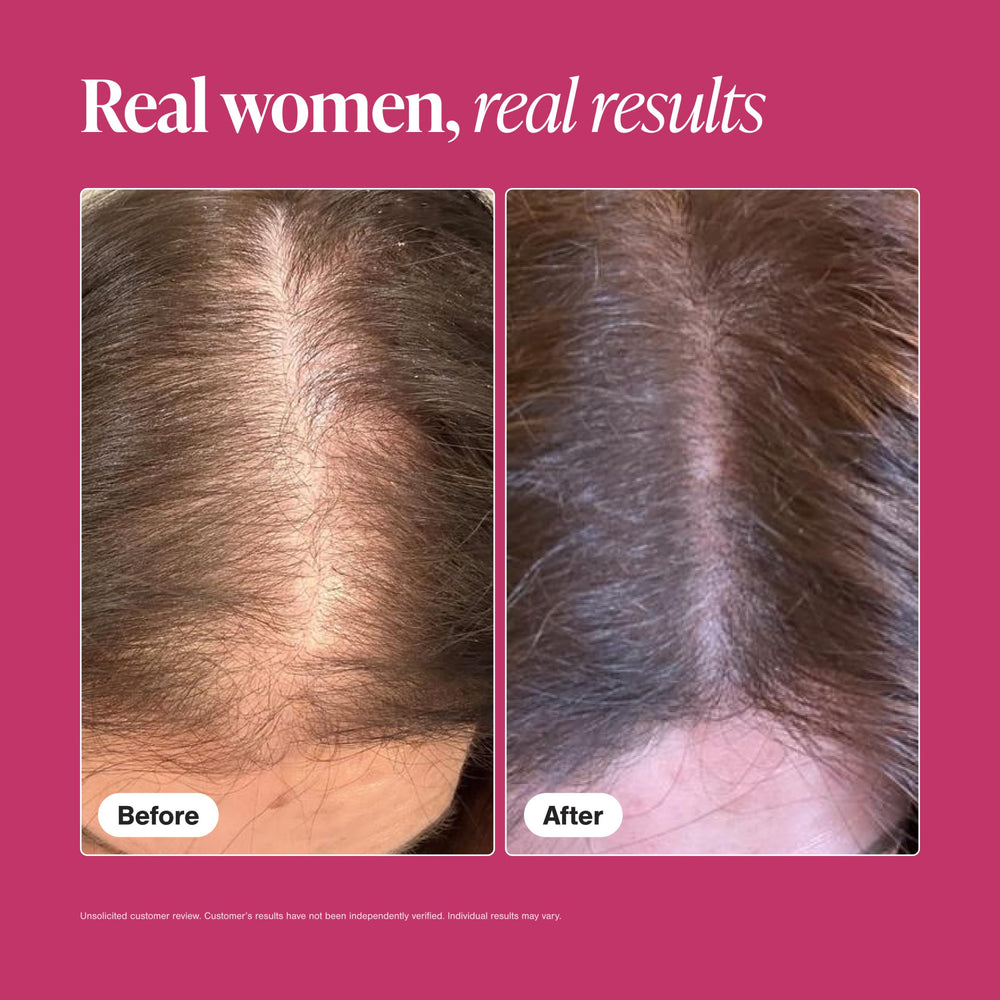 viviscal tablets beside shampoo and conditioner showing complementary routine benefit