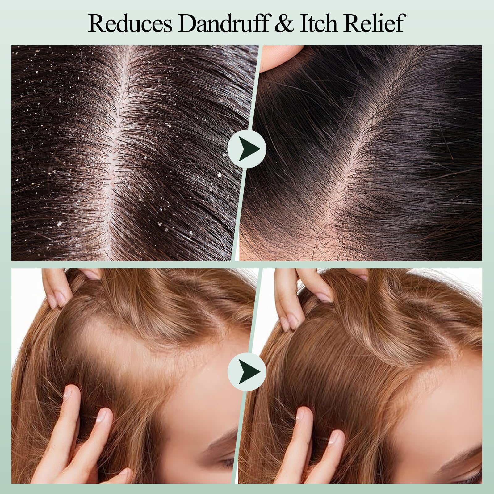 VOERUY peppermint oil refresh visual for cooling scalp comfort