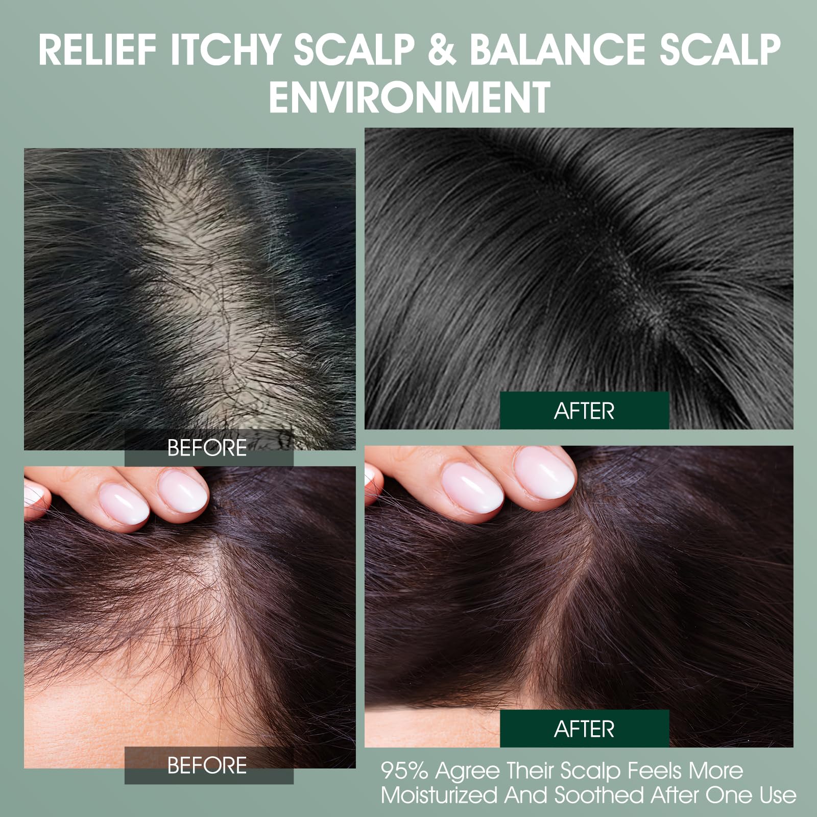 VOERUY Scalp Treatment ingredients visual highlights rosemary and tea tree care.