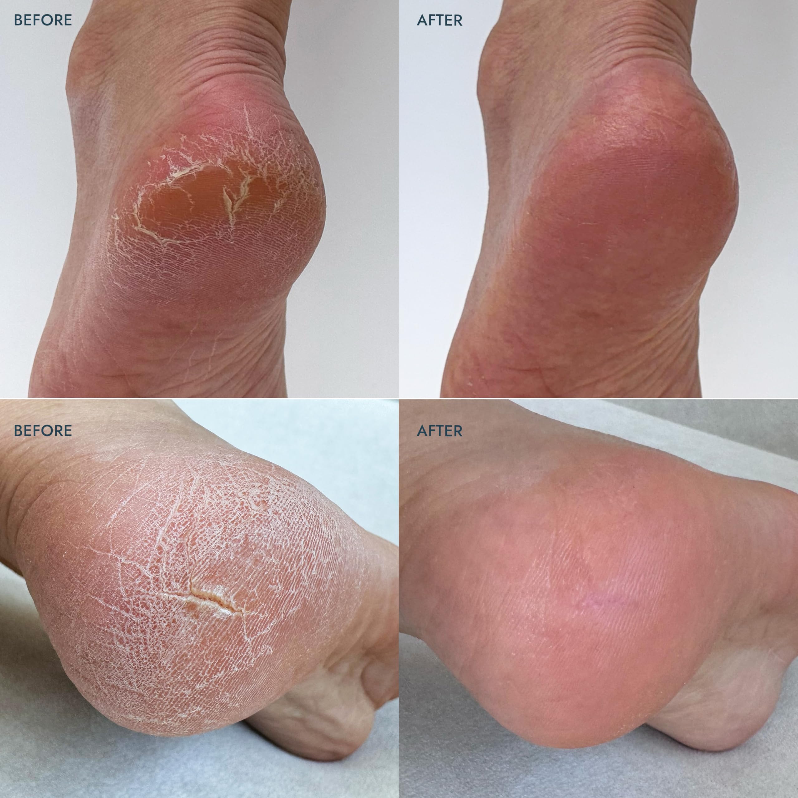 VOESH at-home routine use with socks and balm for relaxed, spa-like evenings.