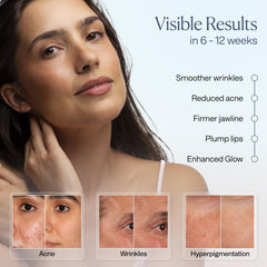 VogueNow LuminX Pro lip coverage area targets light around the lips.