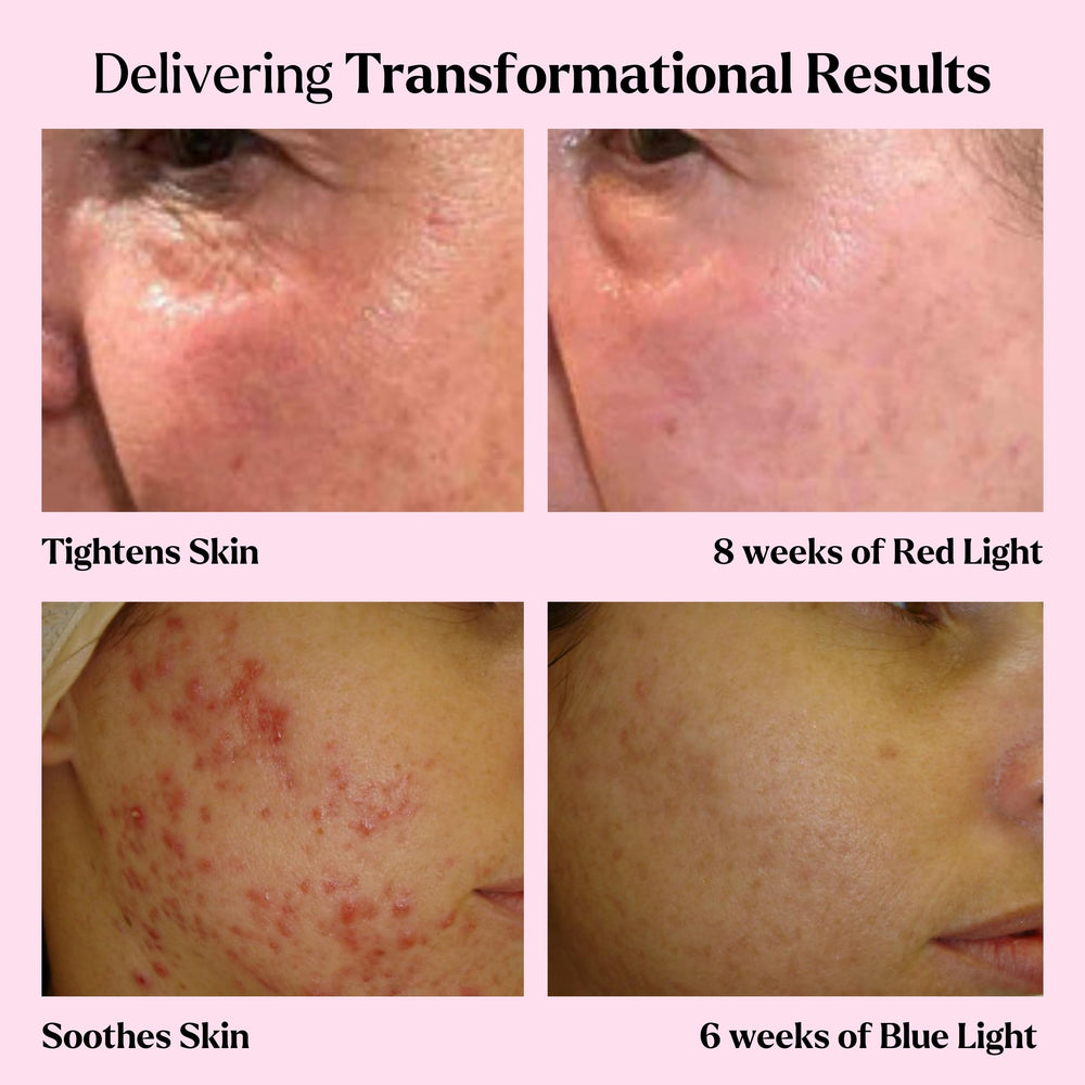 VogueNow Spa kit unboxing showing all four pieces for a complete routine