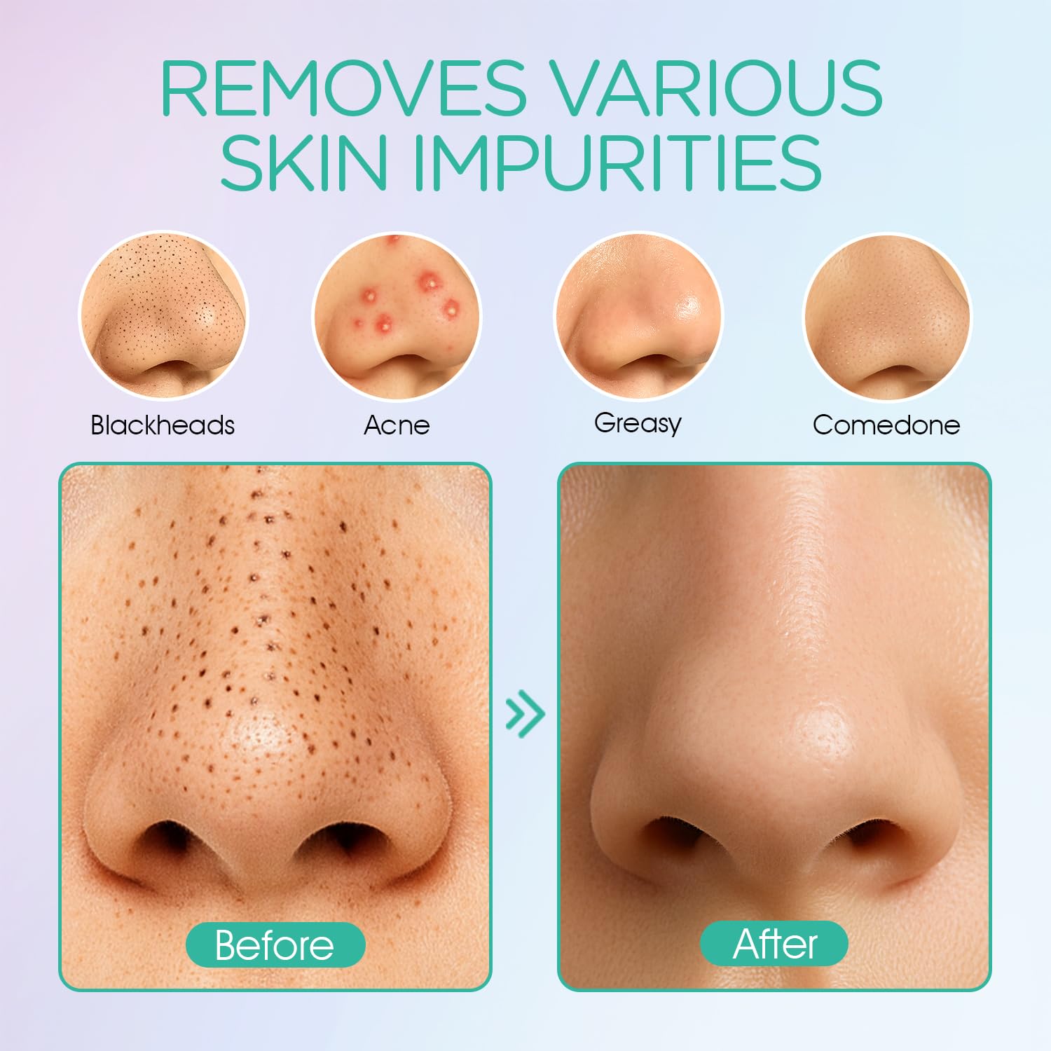 VOYOR Electric face vacuum in compact travel-friendly design for on-the-go cleansing.