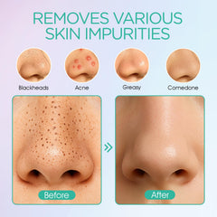 VOYOR Electric face vacuum in compact travel-friendly design for on-the-go cleansing.