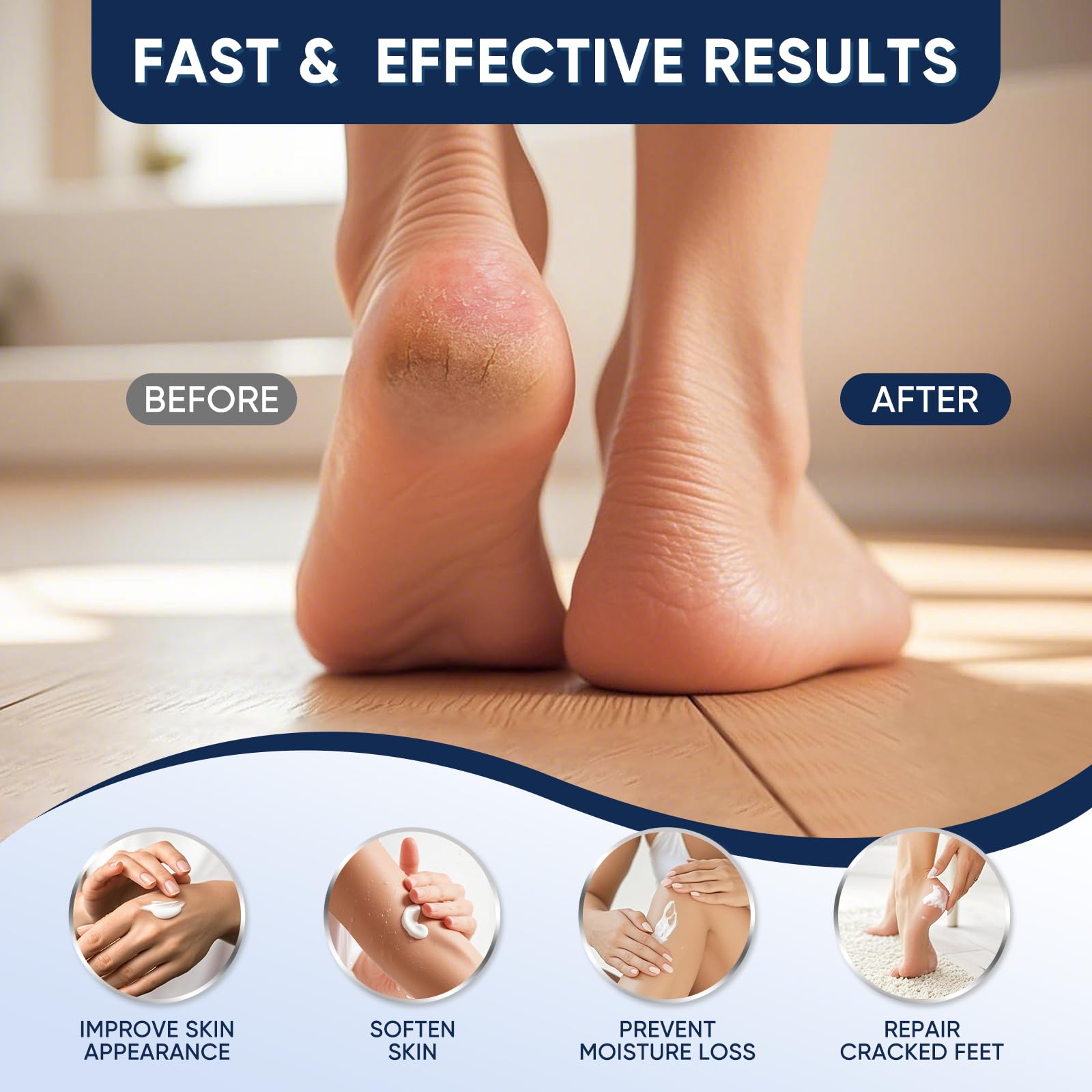 VREKEF Urea Cream on foot heel demonstrates deep moisturization for dry skin.