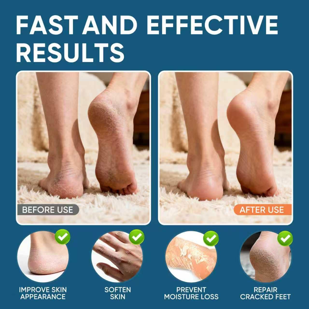 VREKEF Urea Cream 60% tube dispersion demonstrates quick-absorbing formula.