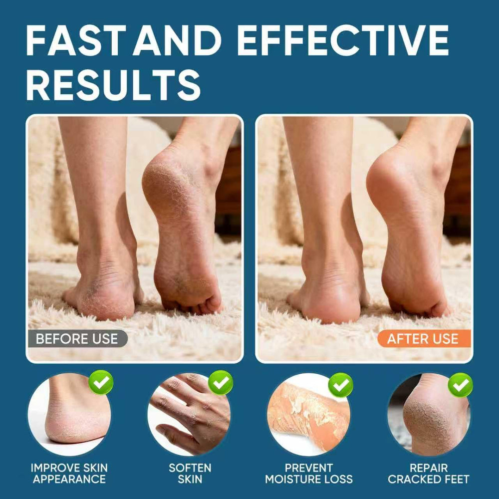 VREKEF Urea Cream 60% tube dispersion demonstrates quick-absorbing formula.