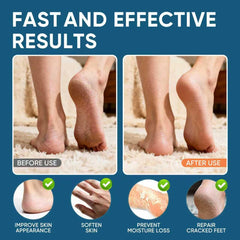 VREKEF Urea Cream 60% tube dispersion demonstrates quick-absorbing formula.