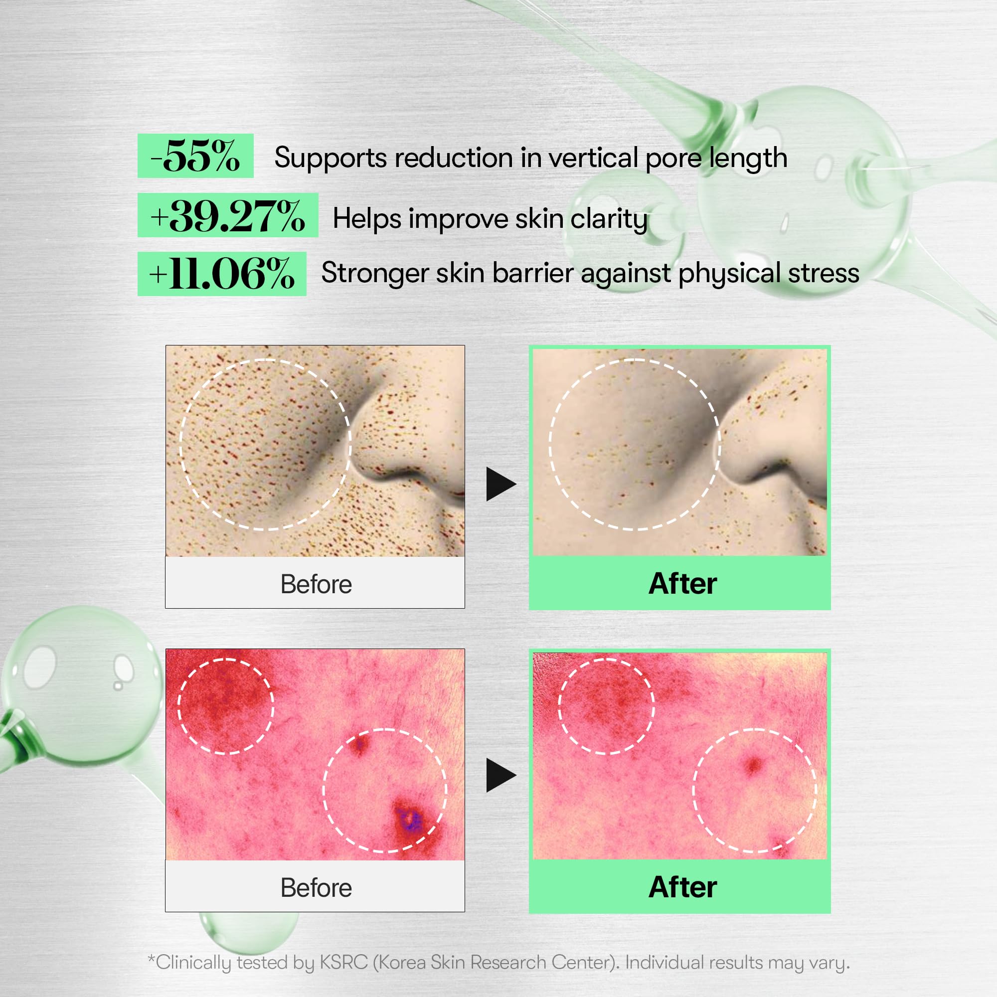VT COSMETICS CICA Reedle Shot exosome boost image signaling boosted nutrient absorption potential.