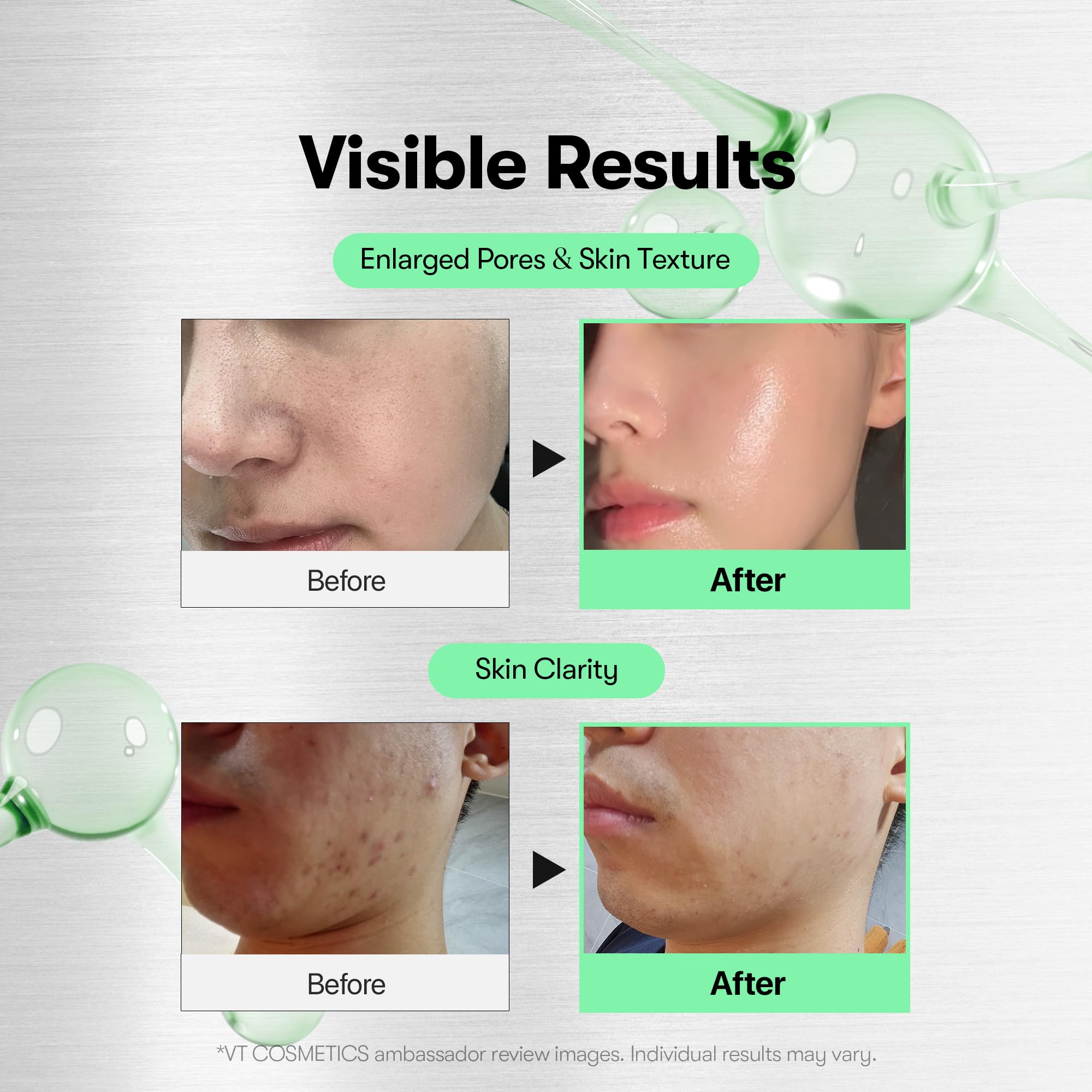 VT COSMETICS Reedle Shot zero-step routine image supports impurity reduction