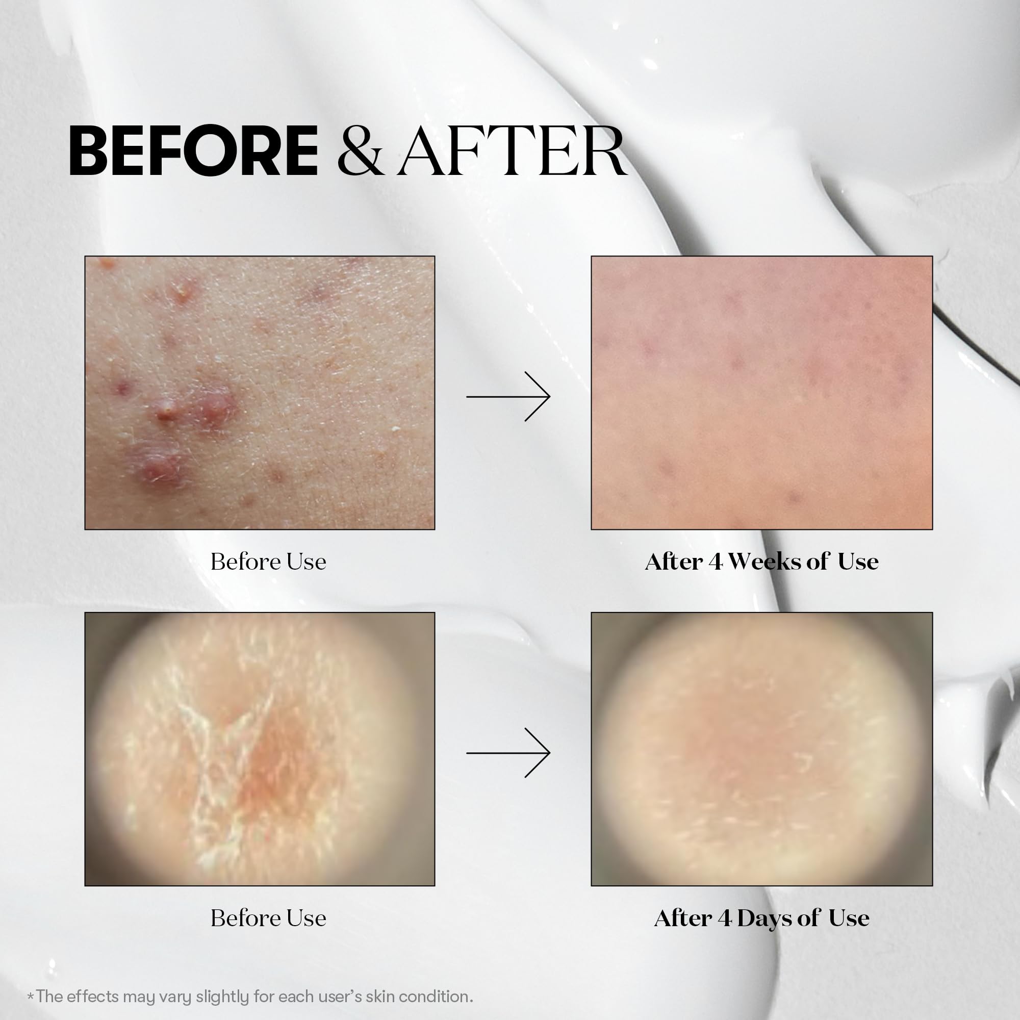 VT COSMETICS Reedle Shot 700 bottle suggests revitalized vitality for daily anti-aging care.