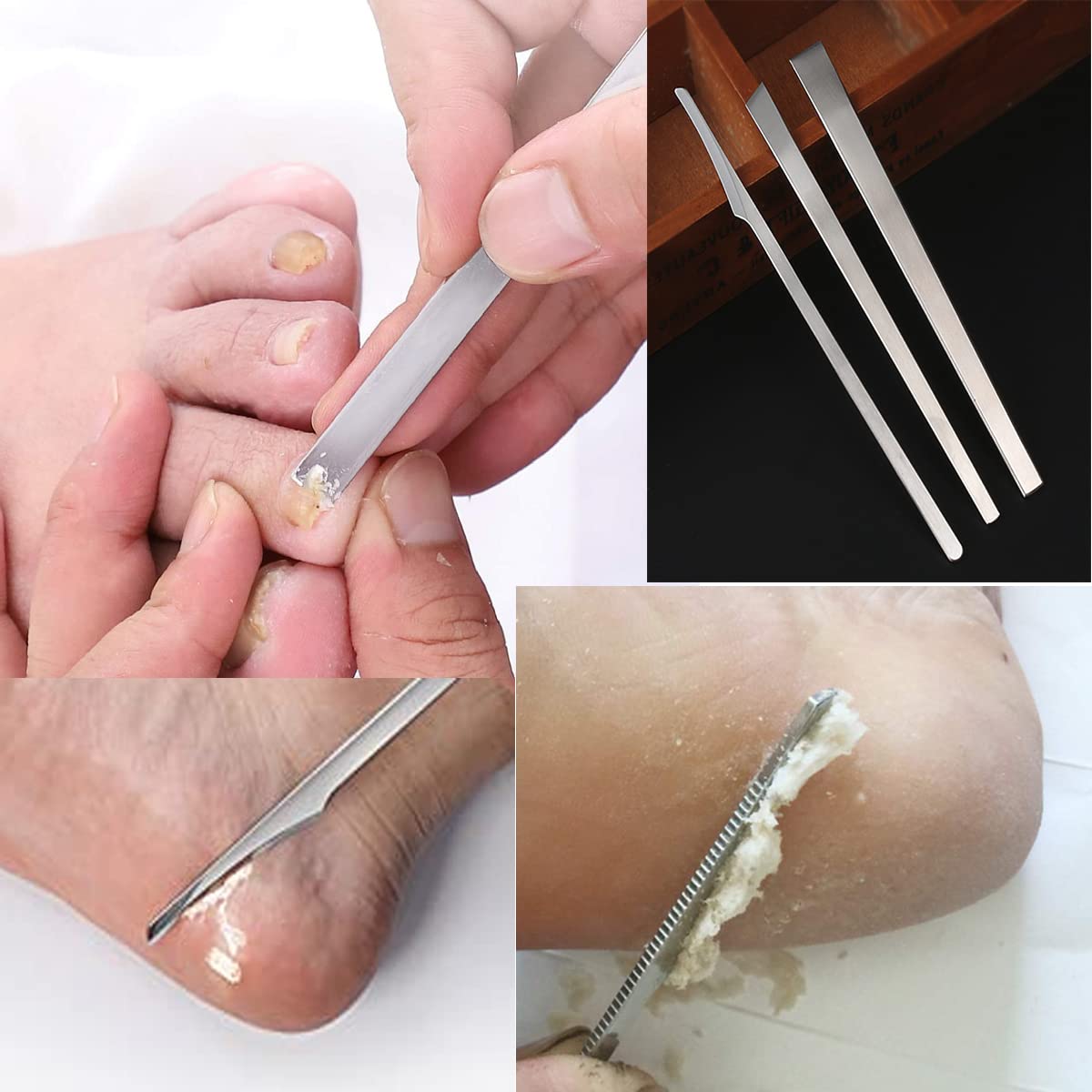 WANLIAN slice knife trims large patches of dead skin and calluses