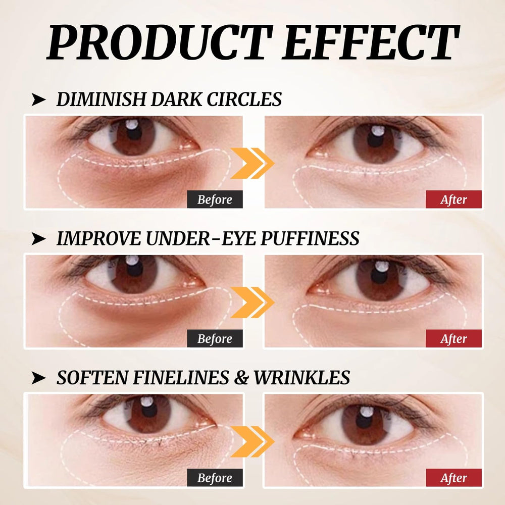 WEU Perfection Eye Tightener packaging display highlights sleek design