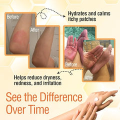 Wild Naturals Manuka Honey Moisturizer swirl texture demonstrates non-greasy absorption ideal for oily skin.