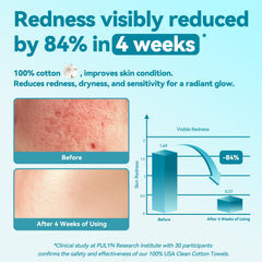 Winner disposable face towel soft fiber close-up—cloud-soft cotton for gentle cleansing.