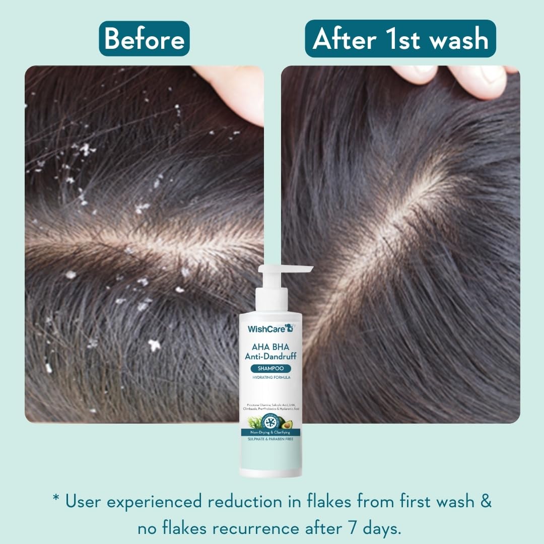 WishCare exfoliation closeup demonstrates AHA/BHA action on the scalp