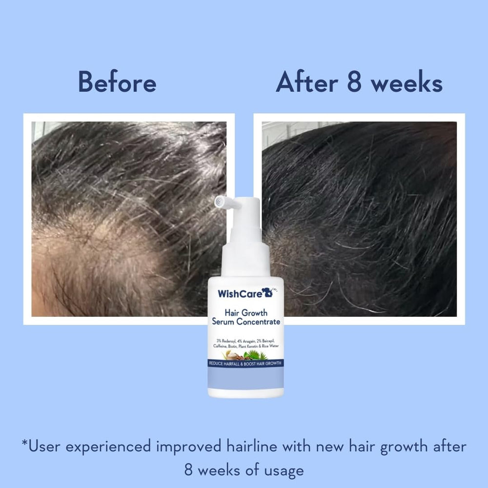 WishCare Redensyl ingredient focus supports density