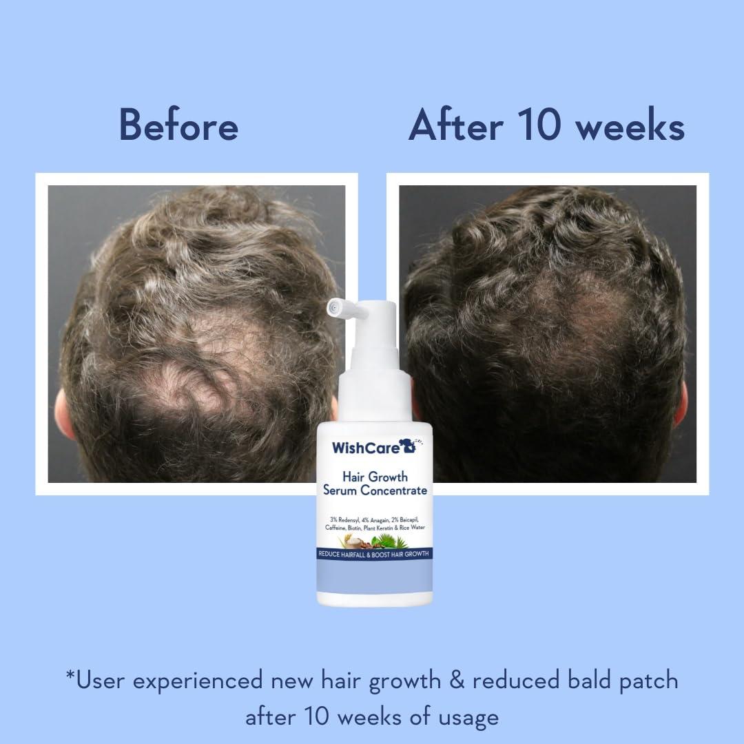 WishCare serum on scalp for lightweight, non-greasy absorption