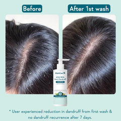 WishCare shampoo lather closeup shows gentle exfoliation for clean, refreshed scalp