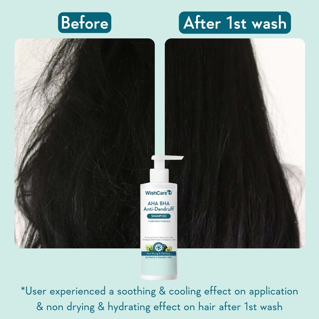 WishCare probiotics and prebiotics label promote scalp microbiome balance