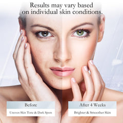 WMK hands applying serum to brighten hands and reduce dark spots