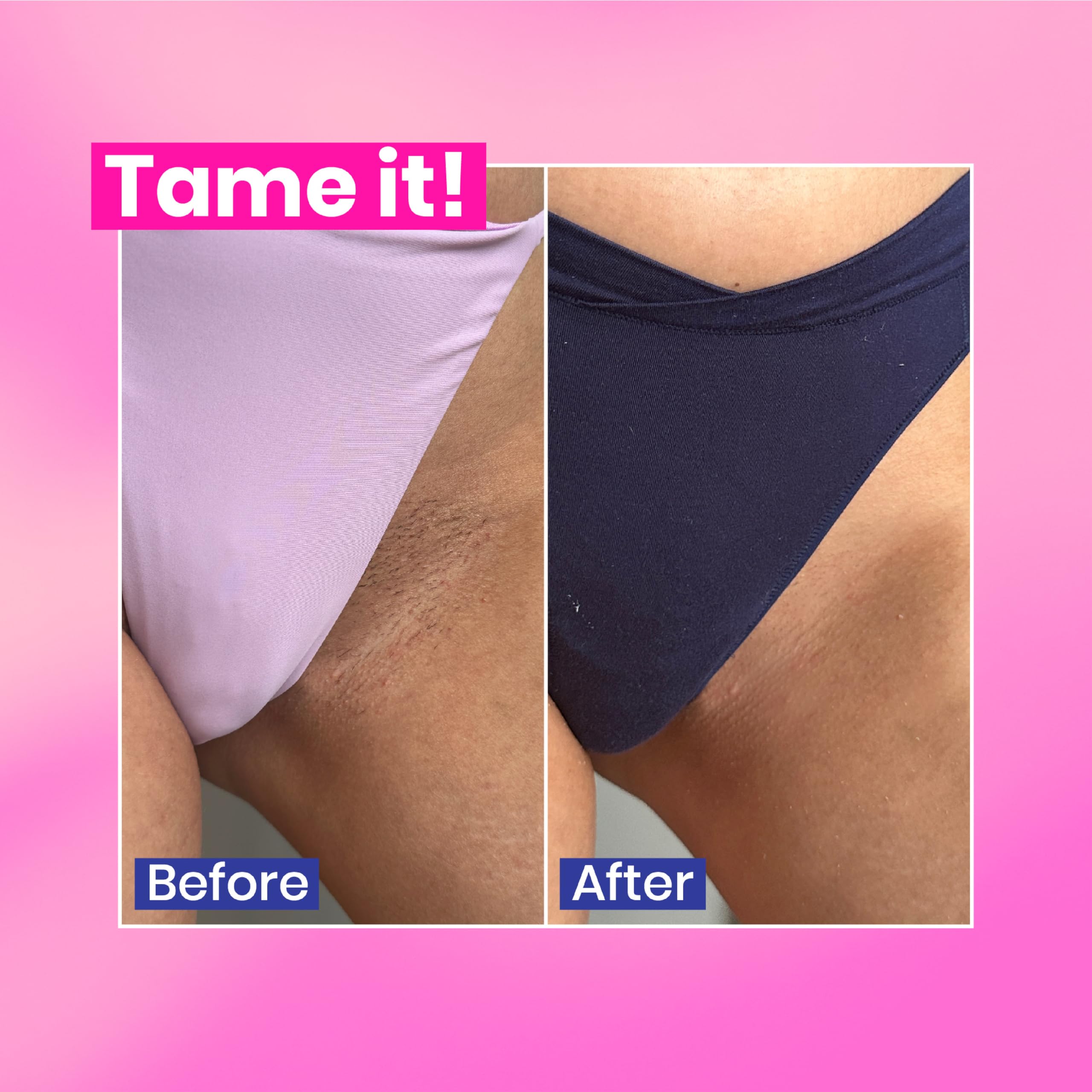 WOOWOO intimate area use demonstrates safe, private hair removal at home
