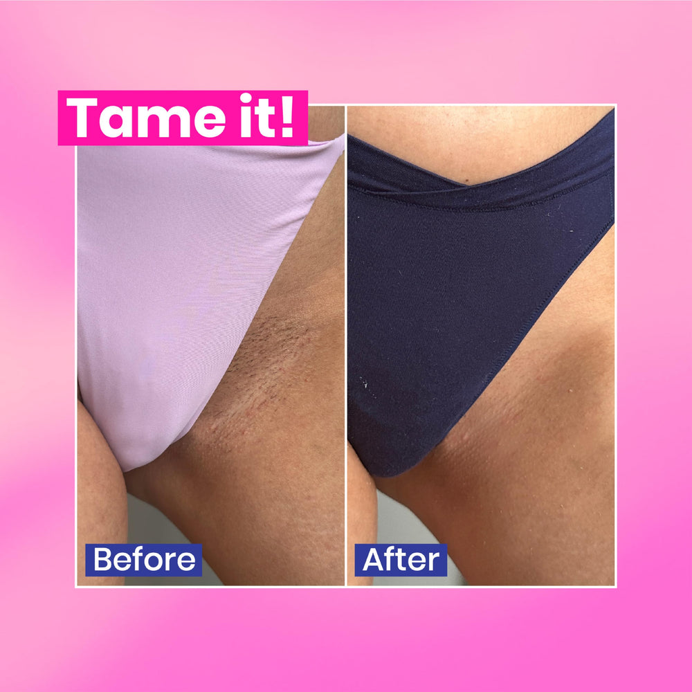 WOOWOO intimate area use demonstrates safe, private hair removal at home