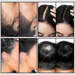 WOZUTUNT hair-fiber-holding-spray-application targets thinning areas precisely