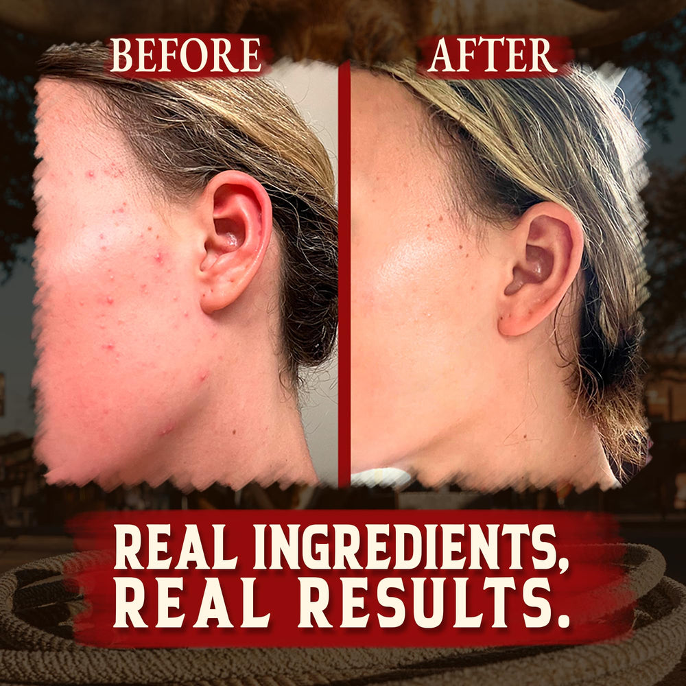 Wrath & Remedy honey-infused tallow balm swirl showing rich, soothing moisture