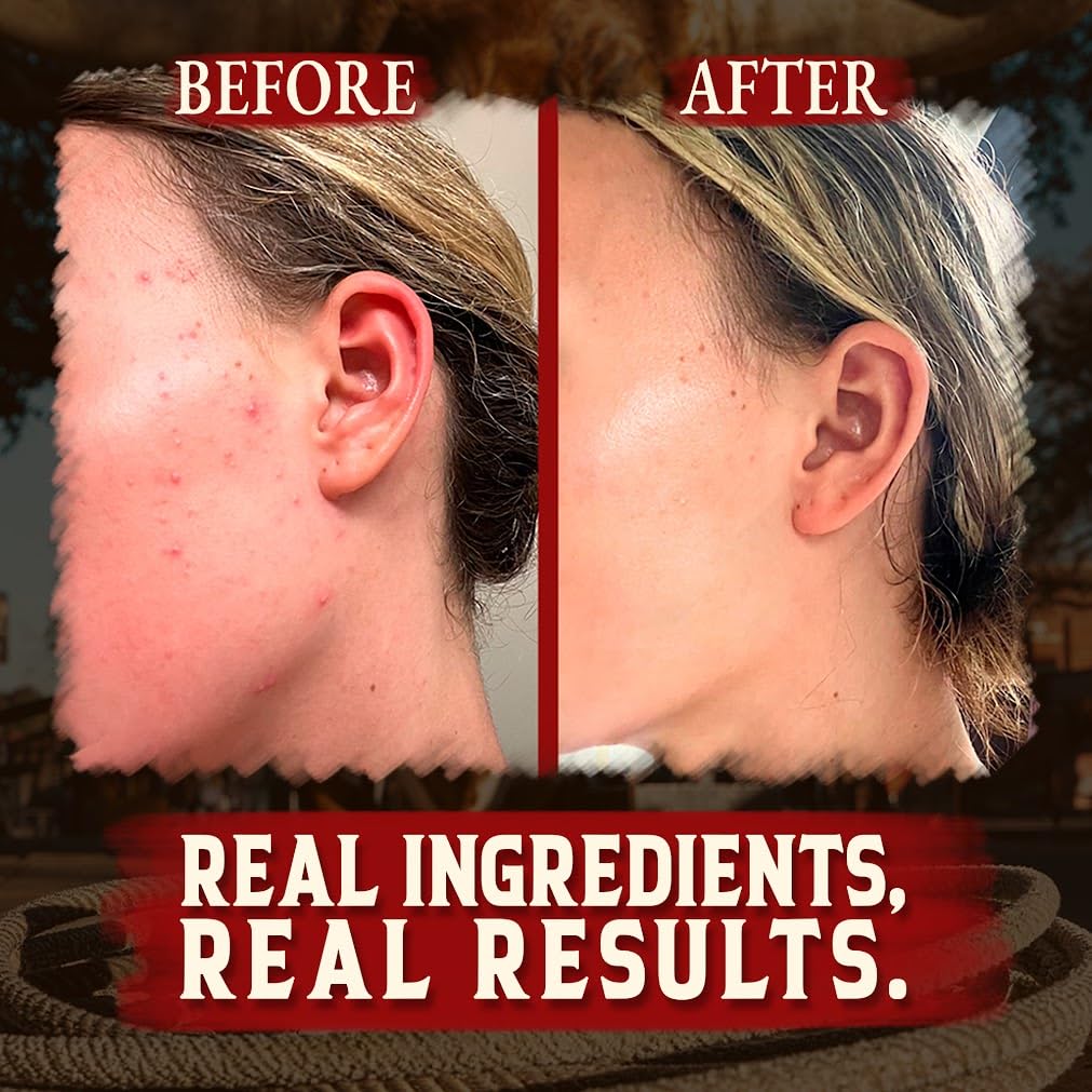 Wrath & Remedy unscented tallow balm bottle offers gentle hydration for sensitive skin