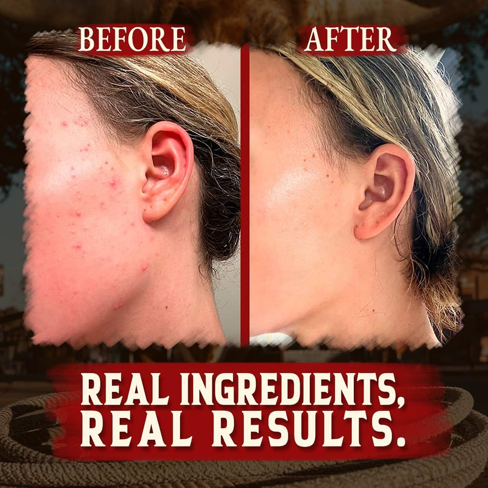 Wrath & Remedy unscented tallow balm bottle offers gentle hydration for sensitive skin