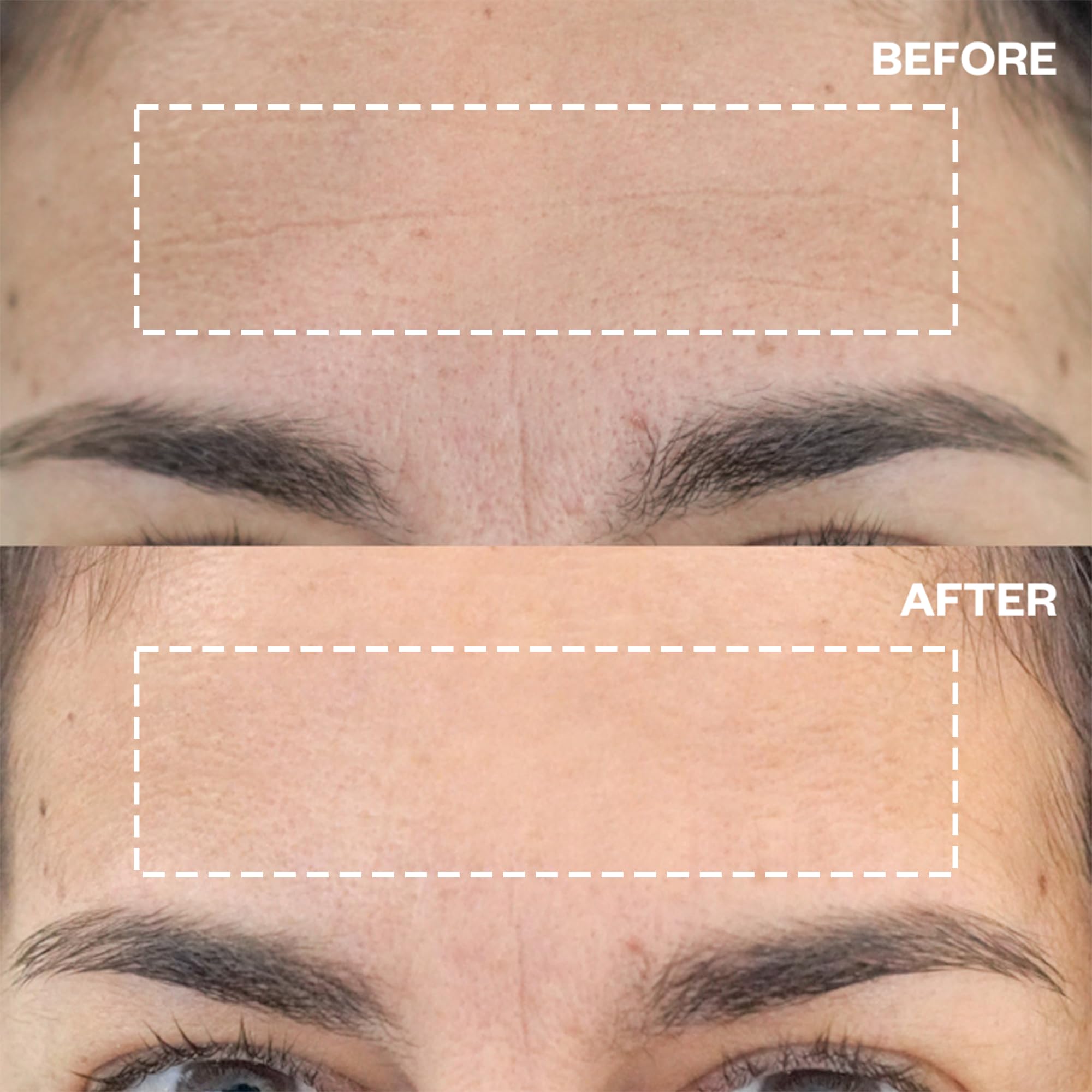 Wrinkles Schminkles forehead patch pack ready for reusable nightly use.