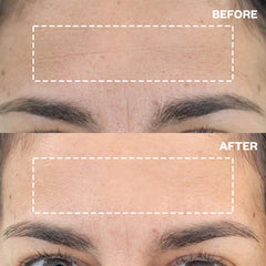 Wrinkles Schminkles forehead patch pack ready for reusable nightly use.