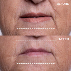 Parche de silicona médica Wrinkles Schminkles protege la zona peribucal y suaviza la piel.