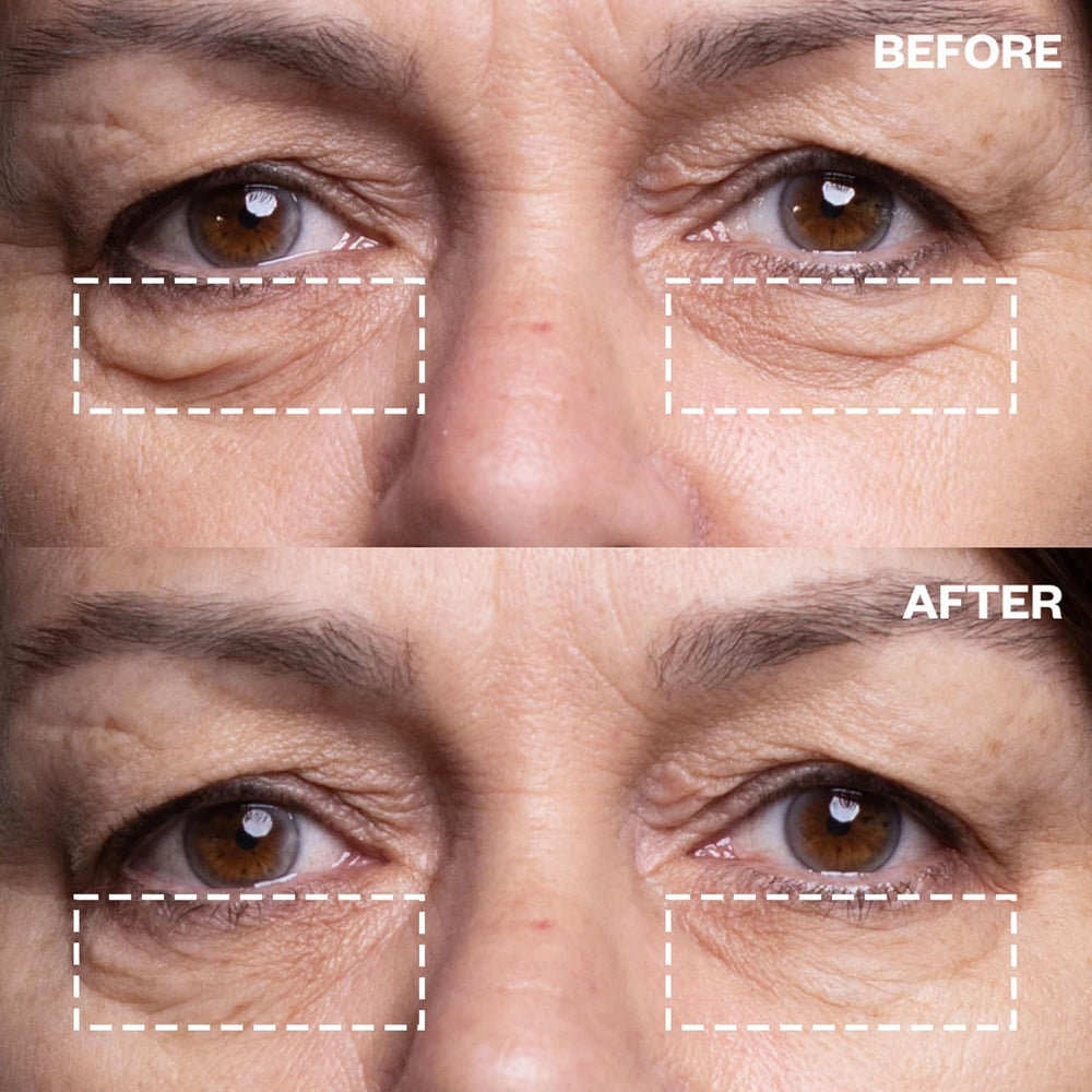 Wrinkles Schminkles under-eye patches applied on skin around the eye area for smoother look