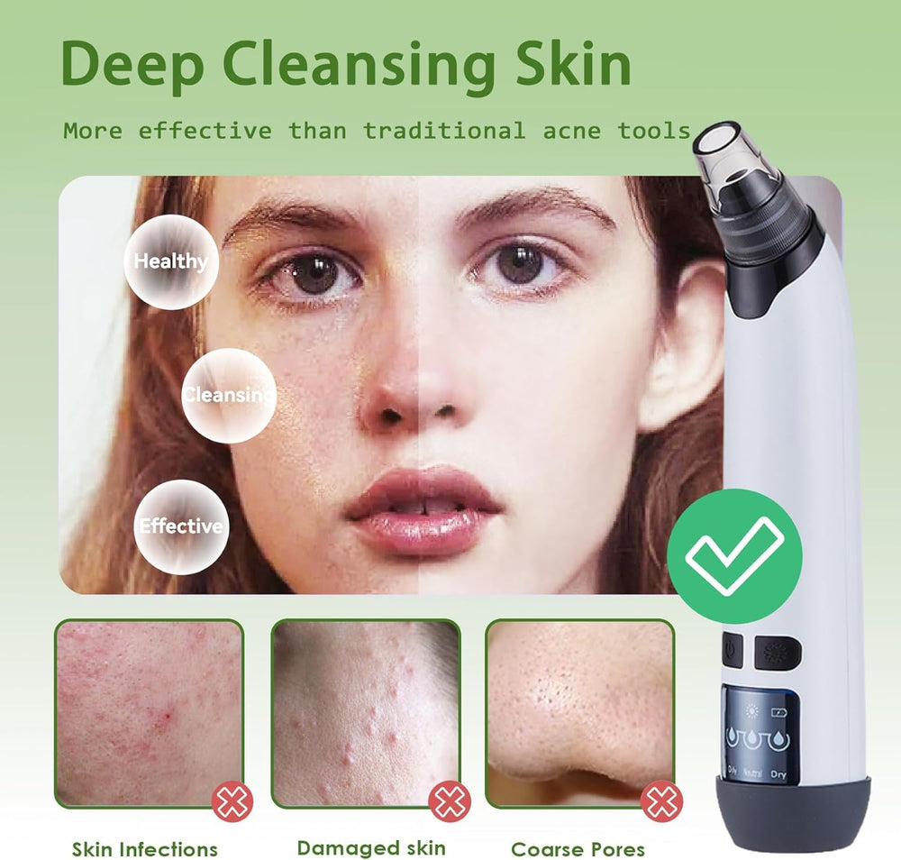 Xamoca blackhead remover vacuum kit in box demonstrates all-in-one skincare solution.