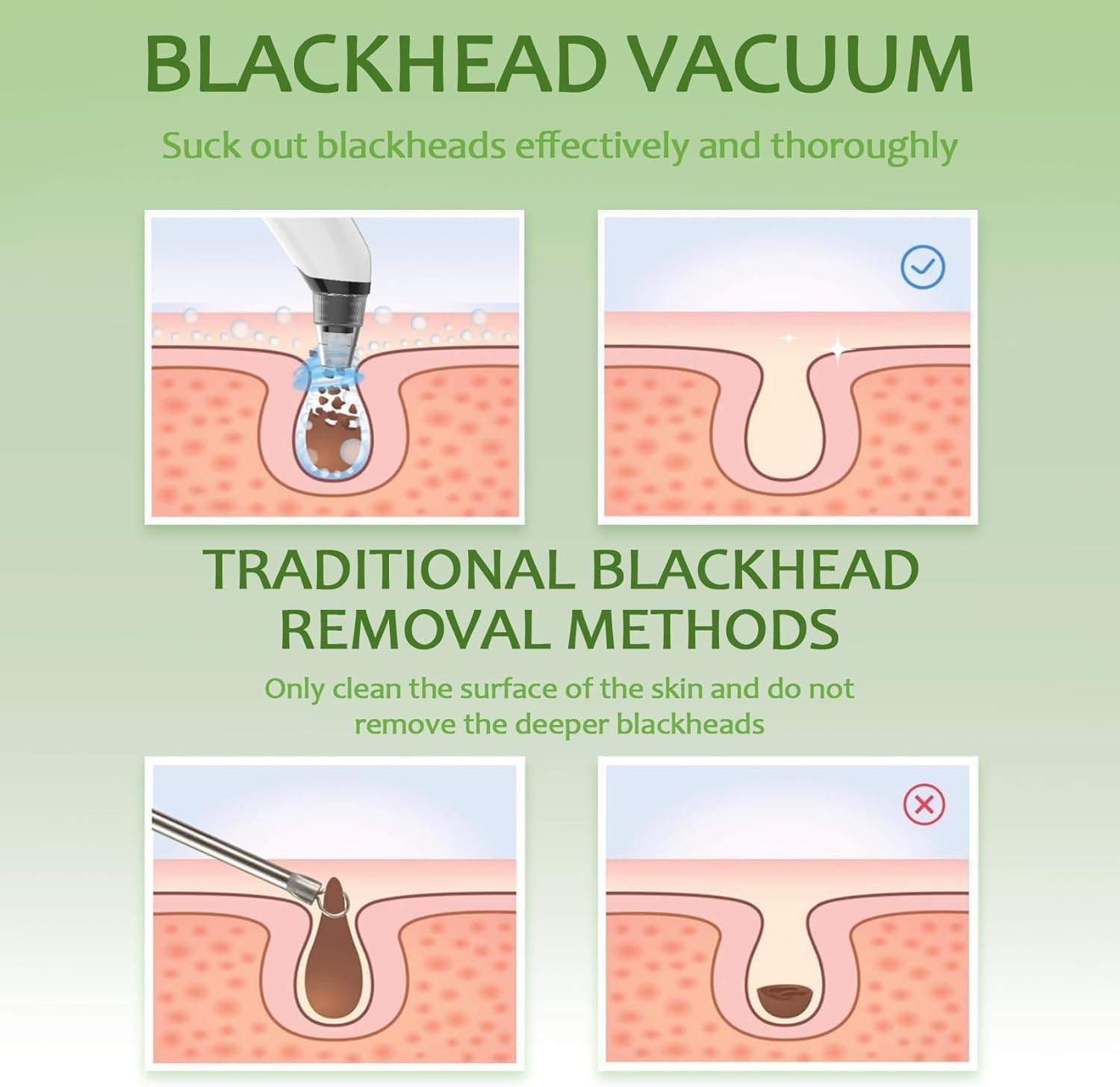 Xamoca blackhead remover vacuum travel case emphasizes on-the-go skincare.