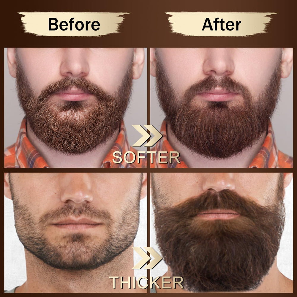Xikezan beard serum two-pack bottles delivering nourishment and softness.