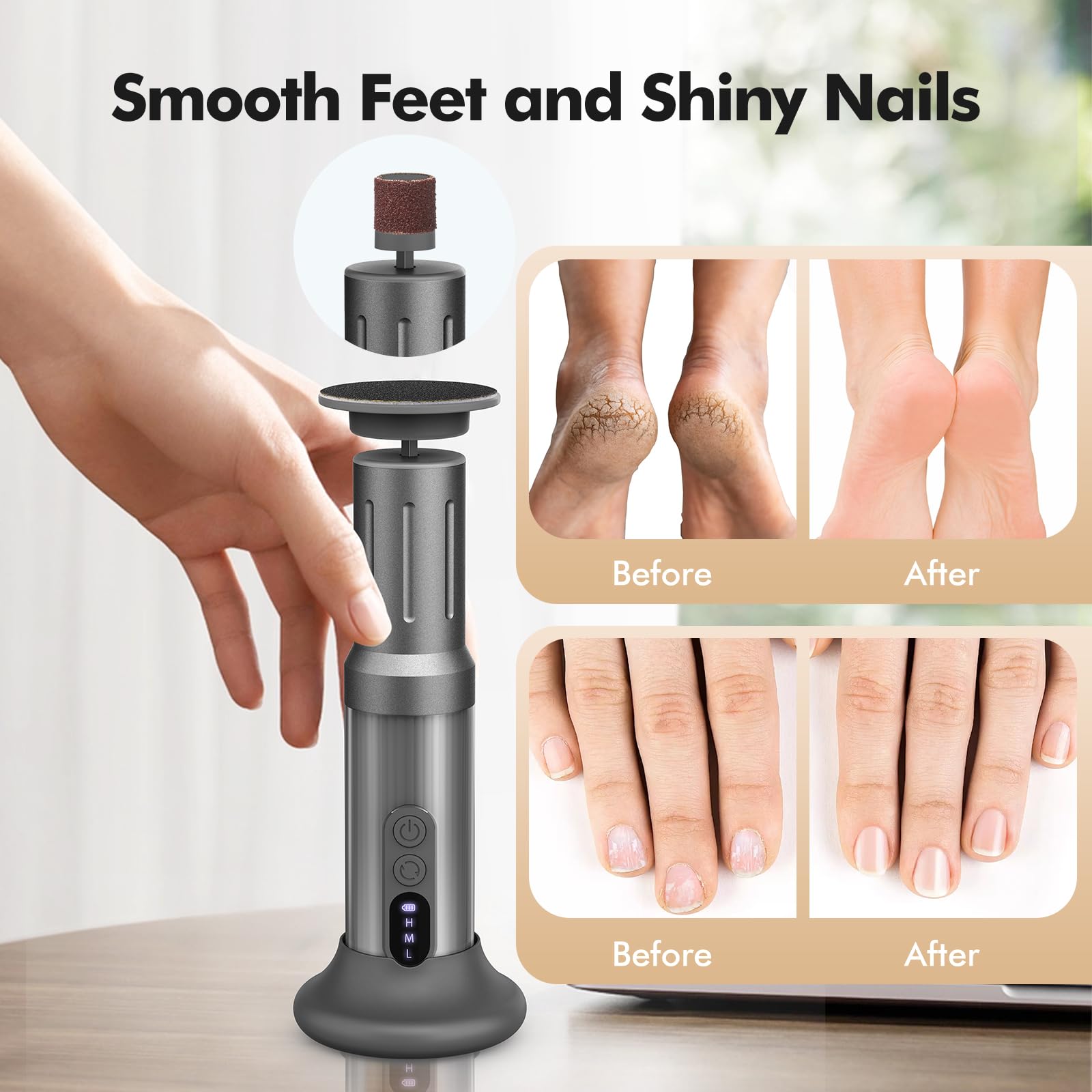 Xisuoka electric foot callus remover ergonomic handle for comfortable grip.
