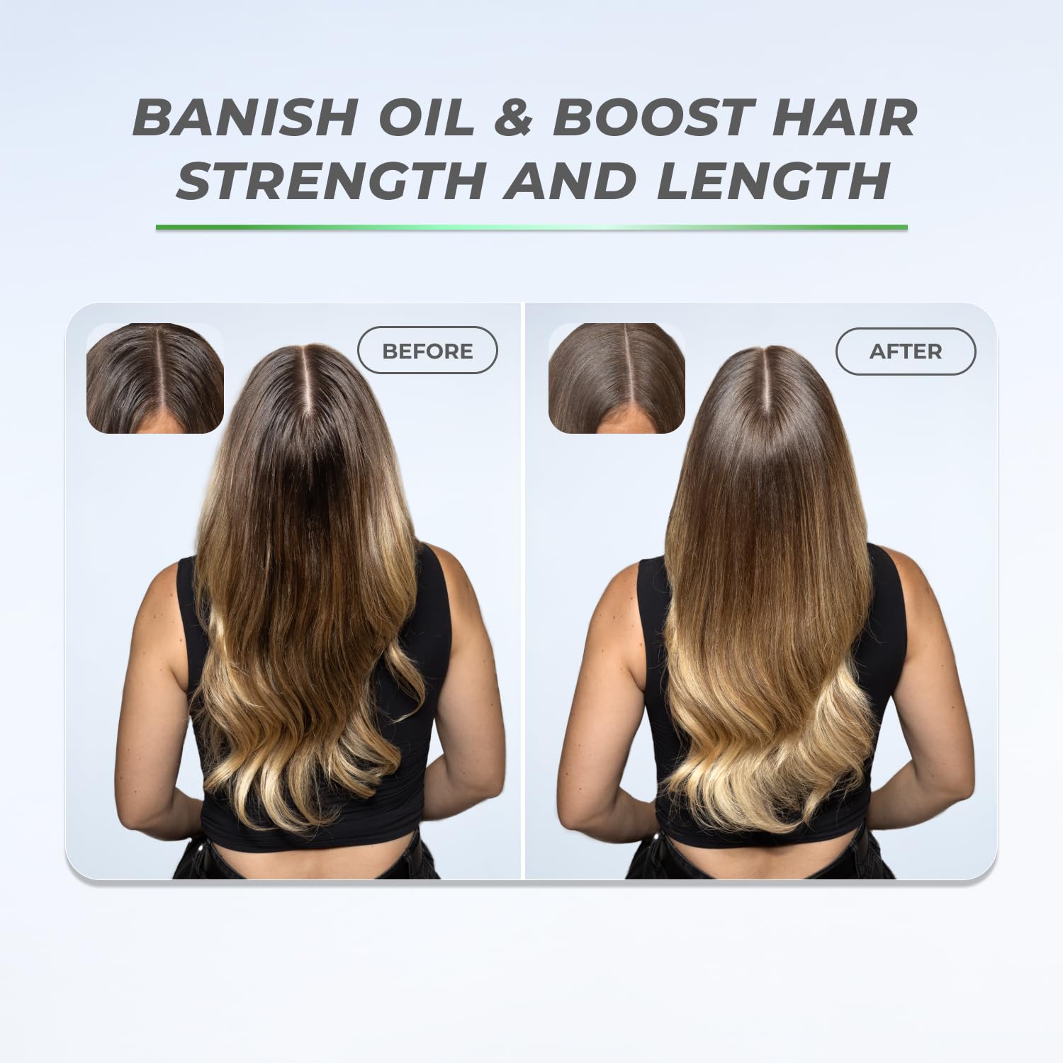 XMONDO Hair BOOST X Dry Shampoo product shot emphasizes root-volume lift.