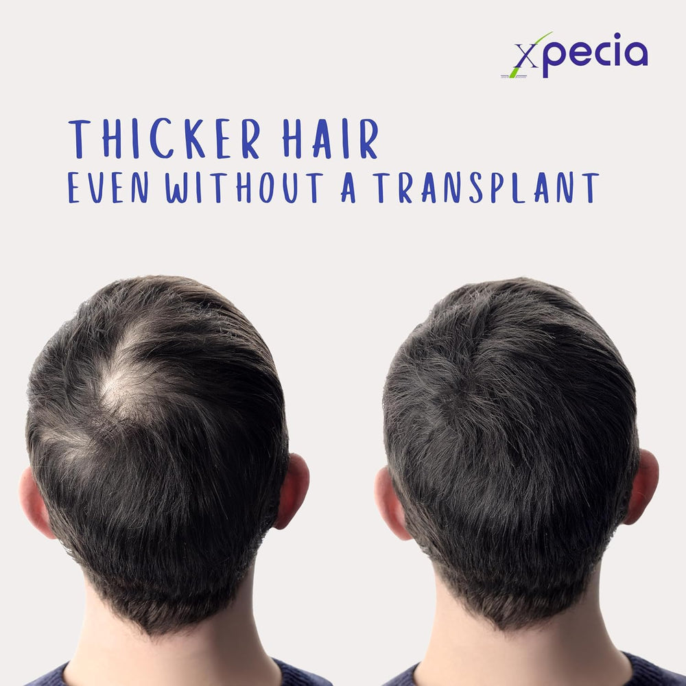 XPECIA for Men on shelf showcases premium hair care
