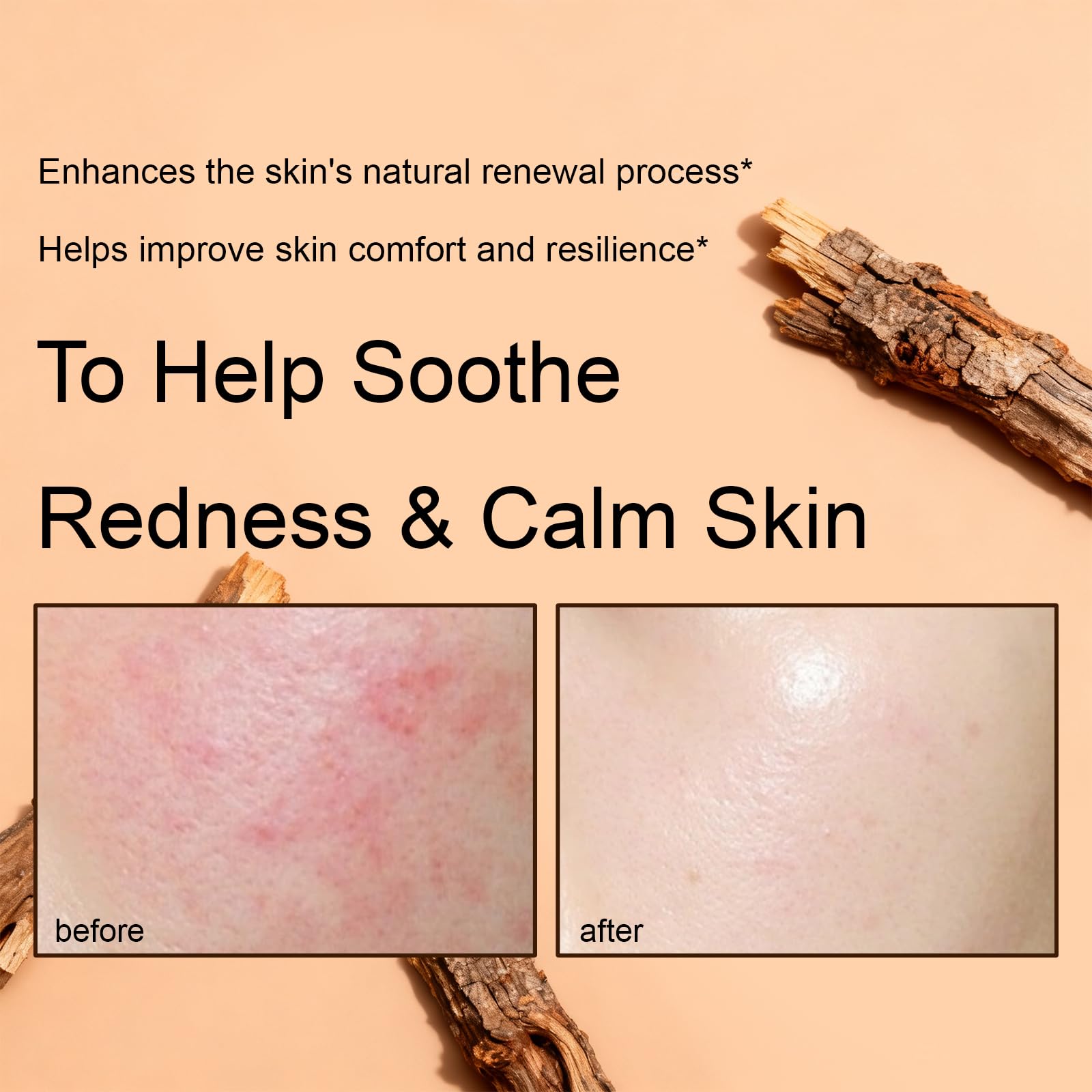 XUHUIT PDRN hydration bloom on skin illustrating boosted moisture.