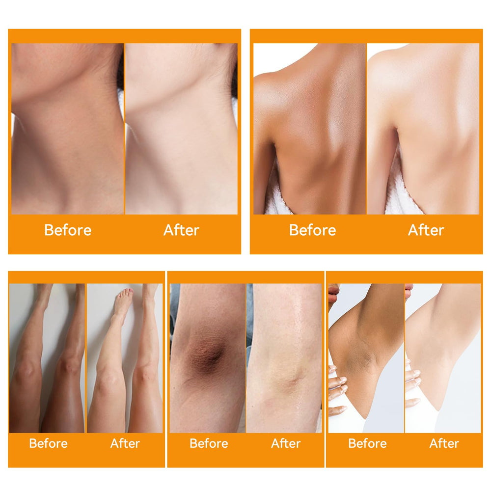 YAFUSIPE elbows and knees cream demonstrates hydrating care.