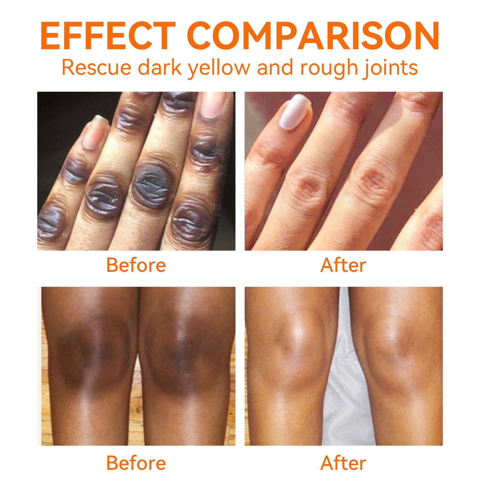 YAFUSIPE underarm cream tube being applied for even-toned skin.