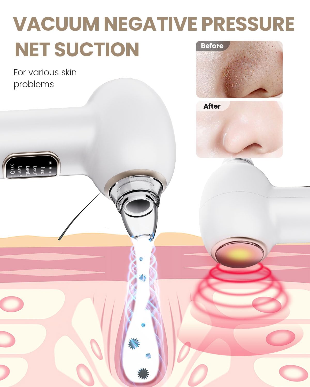 YAGETU Pore Vacuum Kit LED display shows suction level during use.