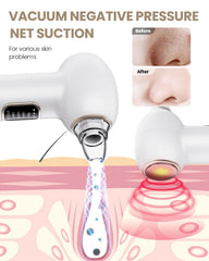 YAGETU Pore Vacuum Kit LED display shows suction level during use.