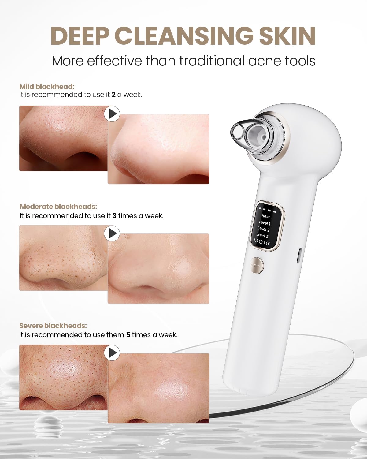 YAGETU Pore Vacuum Kit ideal for targeted cleansing around the nose.