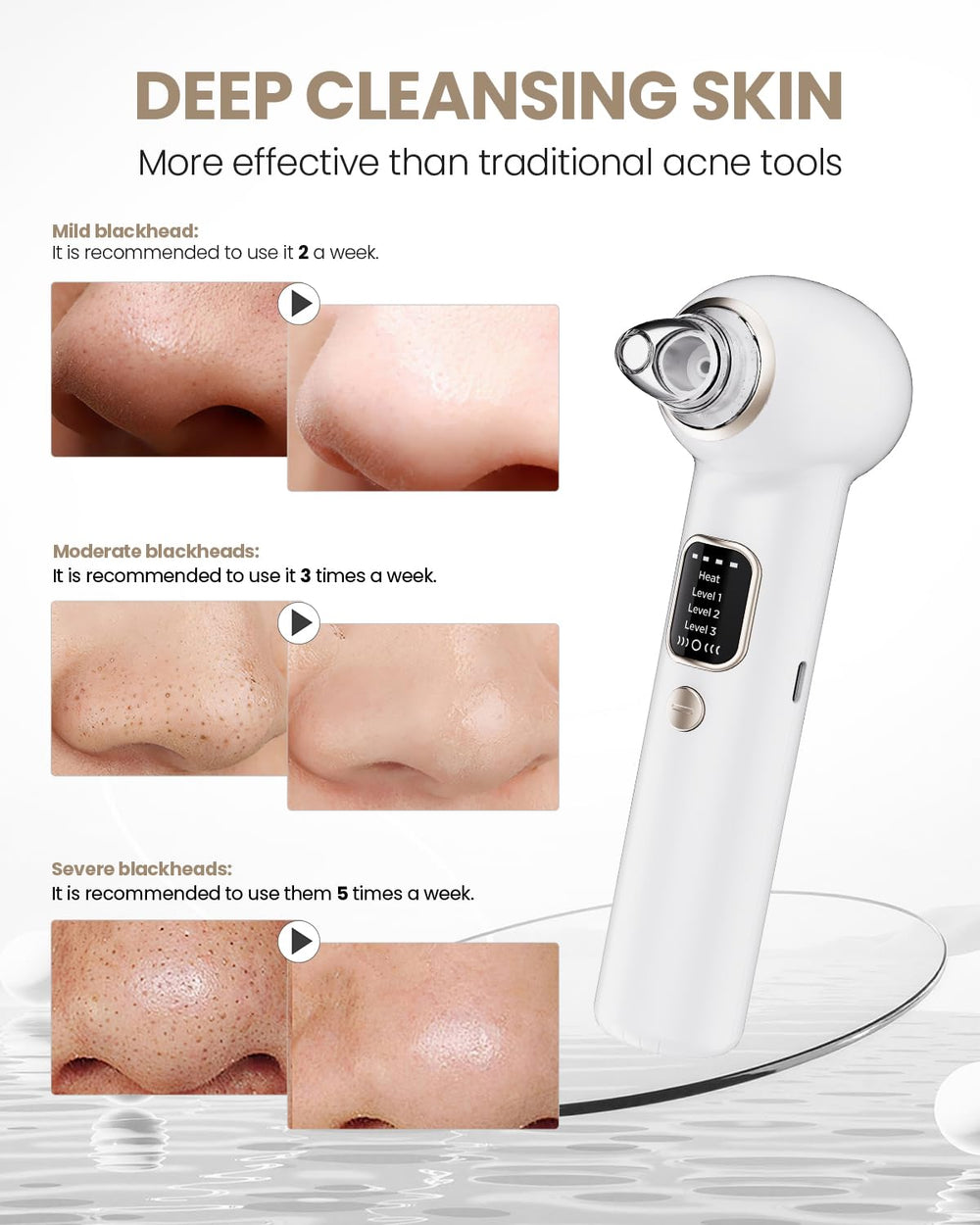 YAGETU Pore Vacuum Kit ideal for targeted cleansing around the nose.